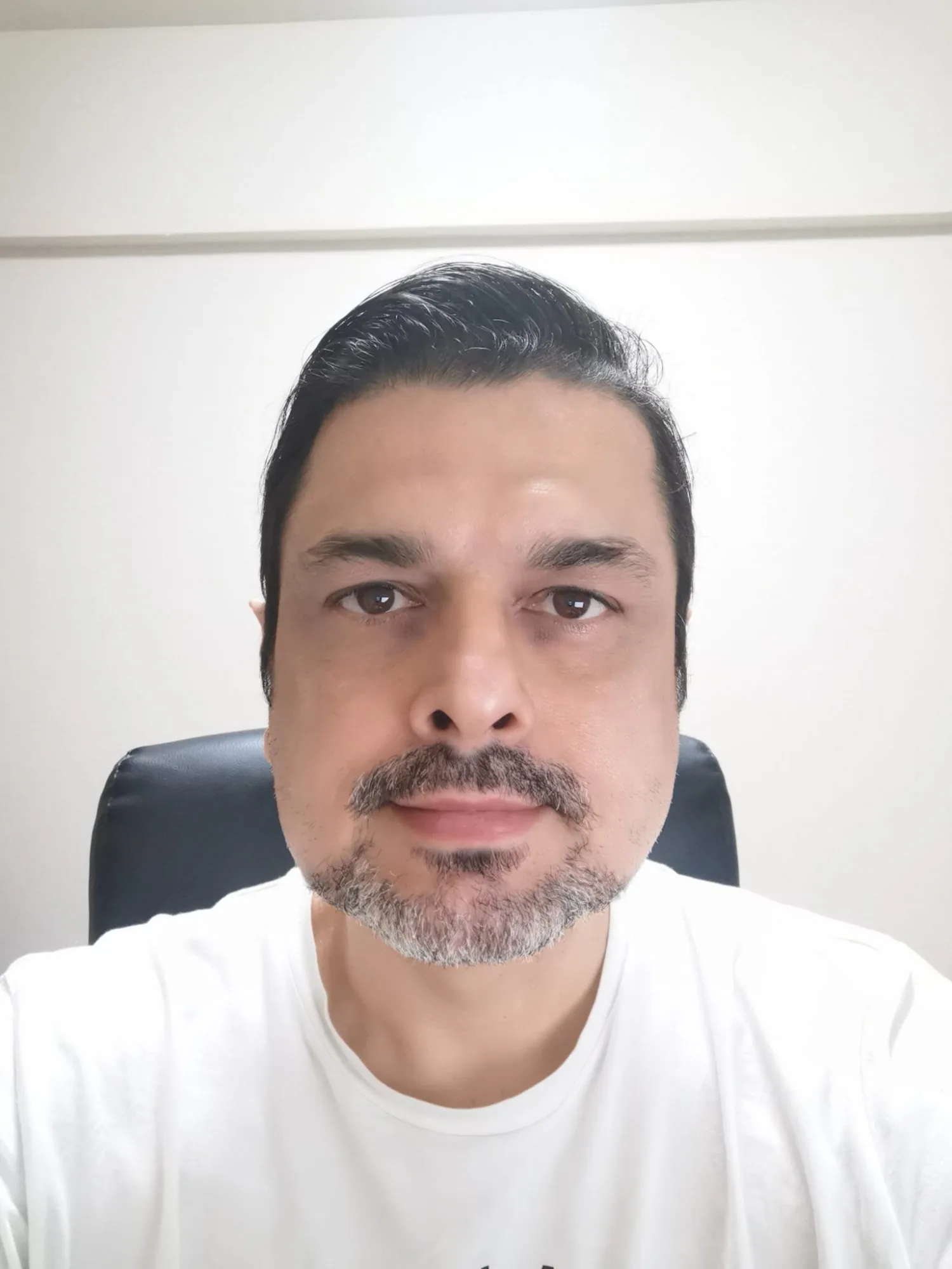 Fernando Ferreira — criador do Protocolo Anti-Pico 30 Dias
